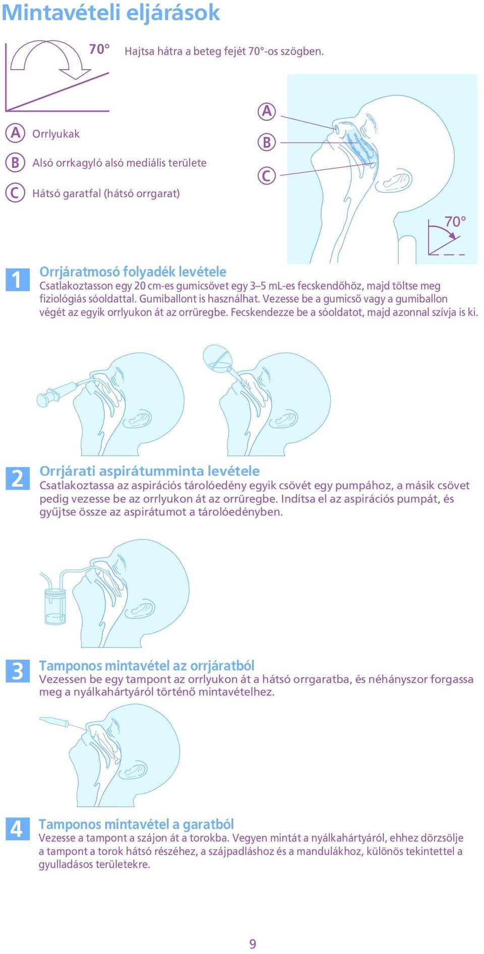 az orrüregbe Fecskendezze be a sóoldatot, majd azonnal szívja is ki 2 Orrjárati aspirátumminta levétele Csatlakoztassa az aspirációs tárolóedény egyik csövét egy pumpához, a másik csövet pedig