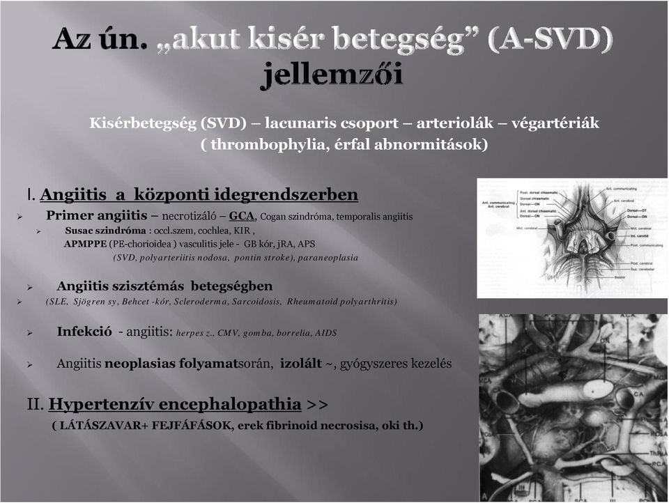 szem, cchlea, KIR, APMPPE (PE-chriidea ) vasculitis jele - GB kór, jra, APS (SVD, plyarteriitis ndsa, pntin strke), paraneplasia Angiitis szisztémás betegségben (SLE,