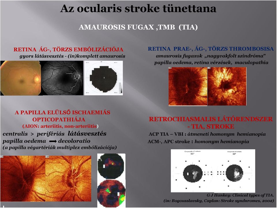 nn-arteriitis) centralis > perifériás látásvesztés papilla edema declrati (a papilla végartériák multiplex embólizációja) RETROCHIASMALIS LÁTÓRENDSZER -