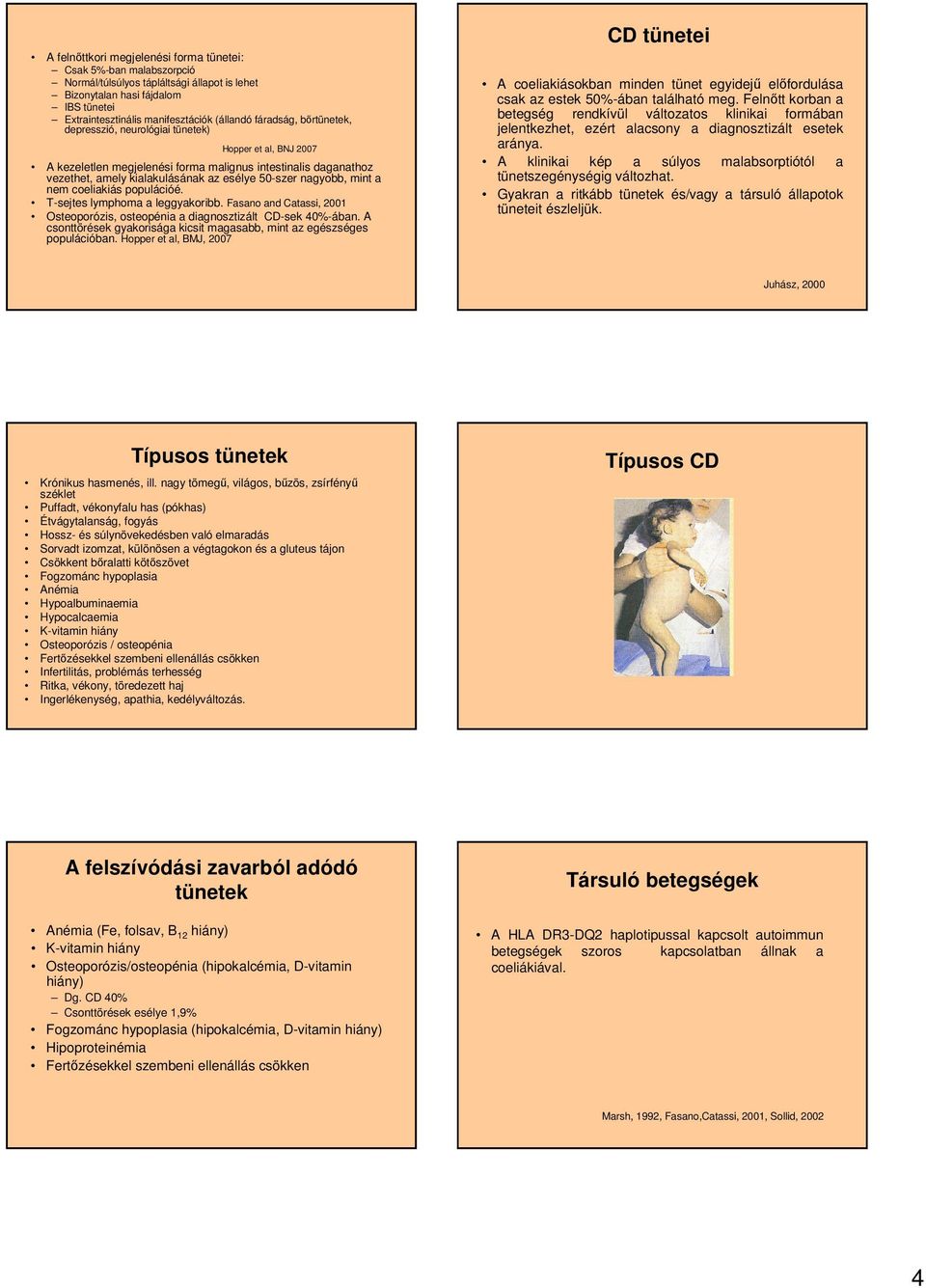 mint a nem coeliakiás populációé. T-sejtes lymphoma a leggyakoribb. Fasano and Catassi, 2001 Osteoporózis, osteopénia a diagnosztizált CD-sek 40%-ában.