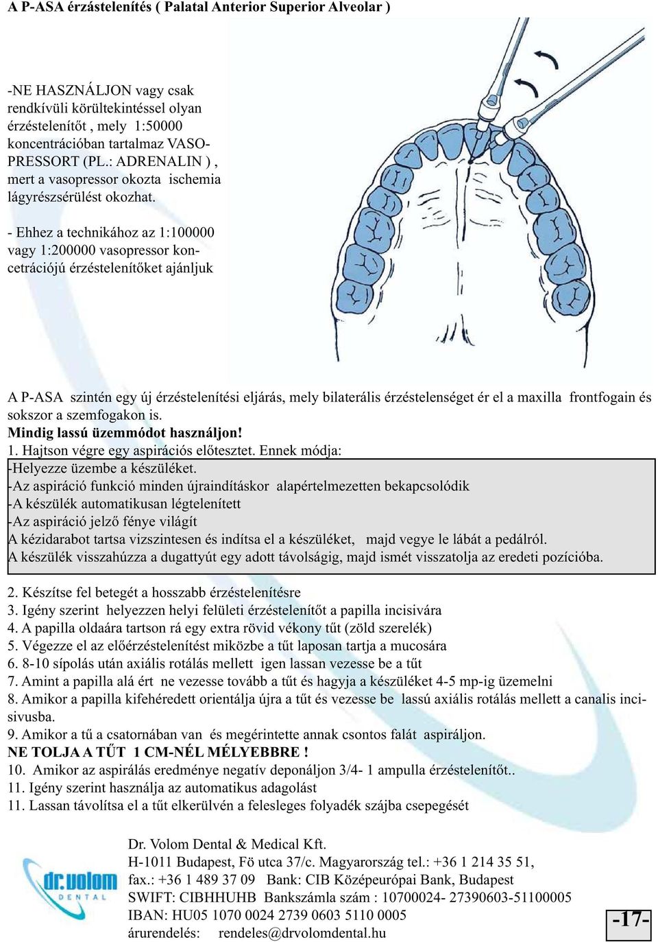 - Ehhez a technikához az 1:100000 vagy 1:200000 vasopressor koncetrációjú érzéstelenítőket ajánljuk A P-ASA szintén egy új érzéstelenítési eljárás, mely bilaterális érzéstelenséget ér el a maxilla