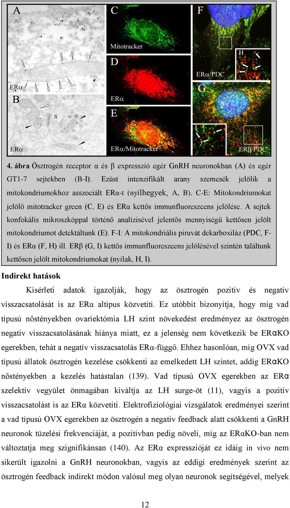 A sejtek konfokális mikroszkóppal történő analízisével jelentős mennyiségű kettősen jelölt mitokondriumot detektáltunk (E). F-I: A mitokondriális piruvát dekarboxiláz (PDC, F- I) és ERα (F, H) ill.