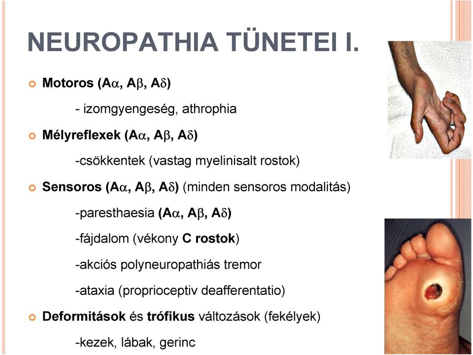 myelinisalt rostok) Sensoros (Aα, Aβ, Aδ)(minden sensoros modalitás) -paresthaesia (Aα, Aβ,