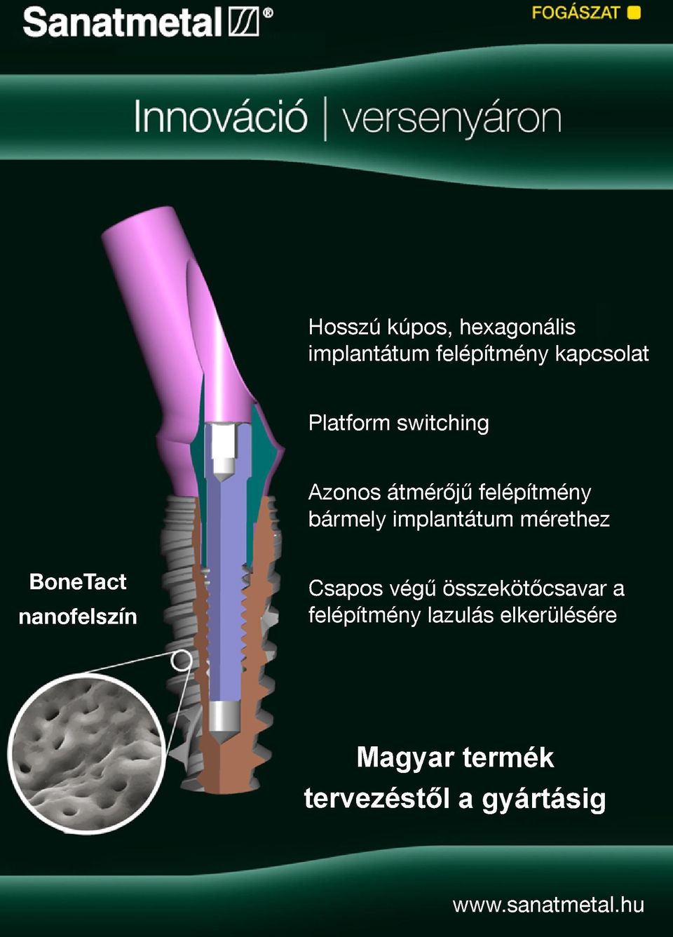 BoneTact nanofelszín Csapos végű összekötőcsavar a felépítmény