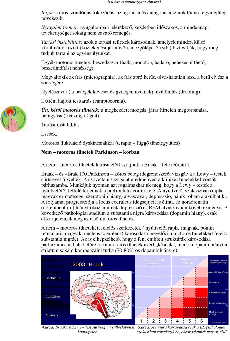 Tartási instabilitás: azok a tartási reflexek károsodnak, amelyek minden külső körülmény között (közlekedési járművön, mozgólépcsőn stb.) biztosítják, hogy meg tudjuk tartani az egyensúlyunkat.