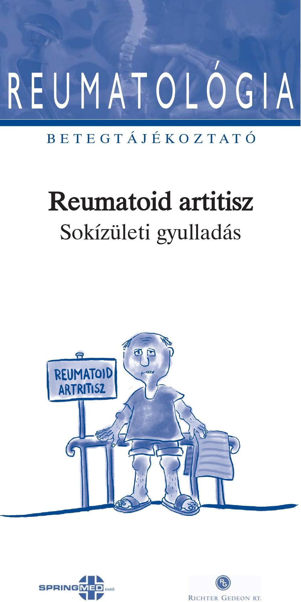 Reumatoid