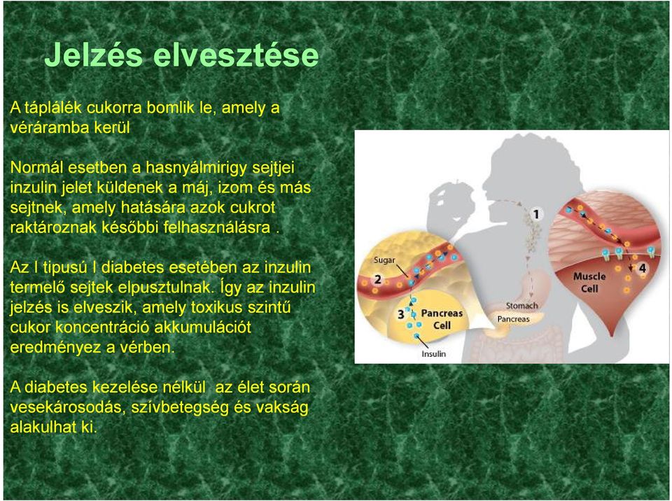 Az I tipusú I diabetes esetében az inzulin termelő sejtek elpusztulnak.