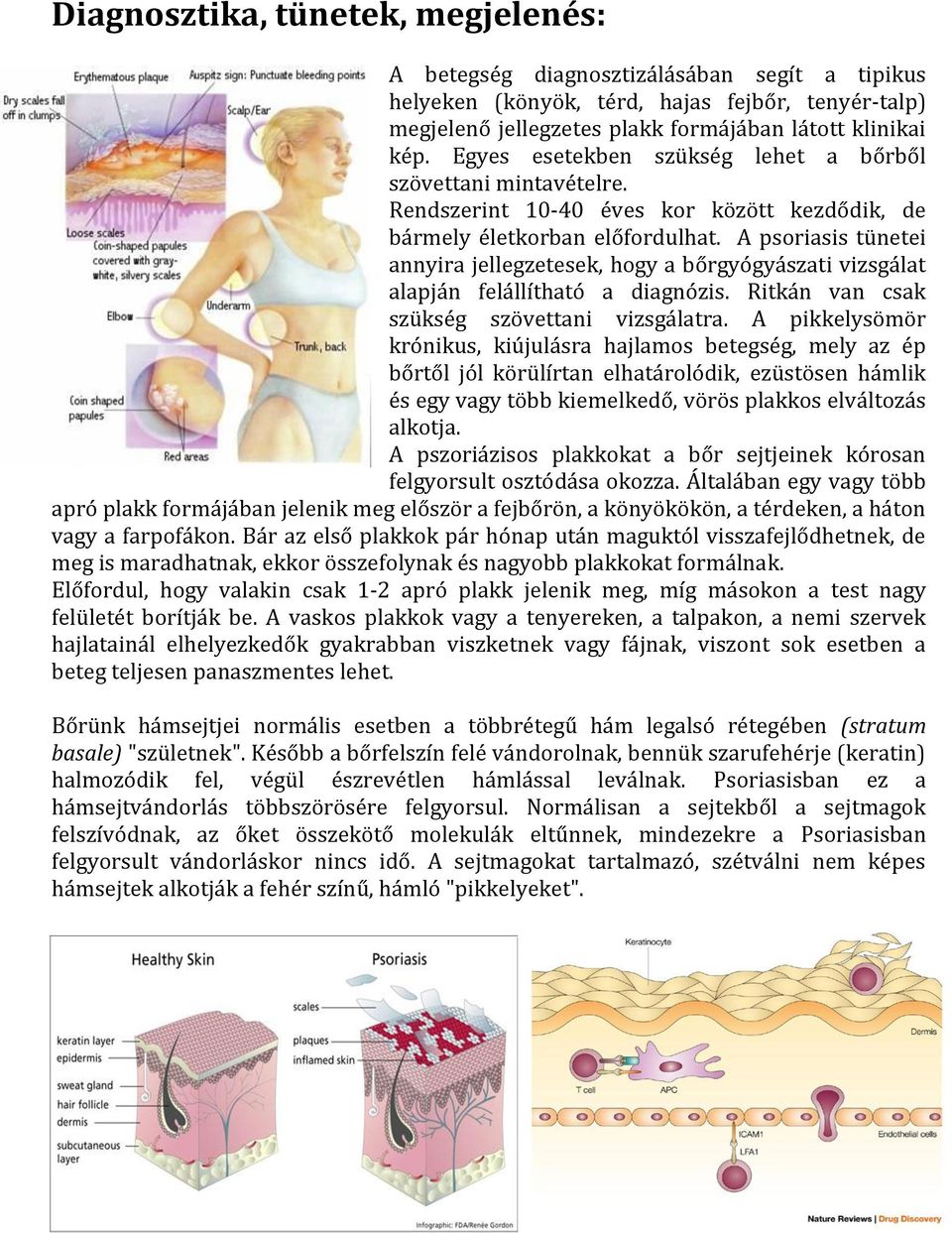 A psoriasis tünetei annyira jellegzetesek, hogy a bőrgyógyászati vizsgálat alapján felállítható a diagnózis. Ritkán van csak szükség szövettani vizsgálatra.