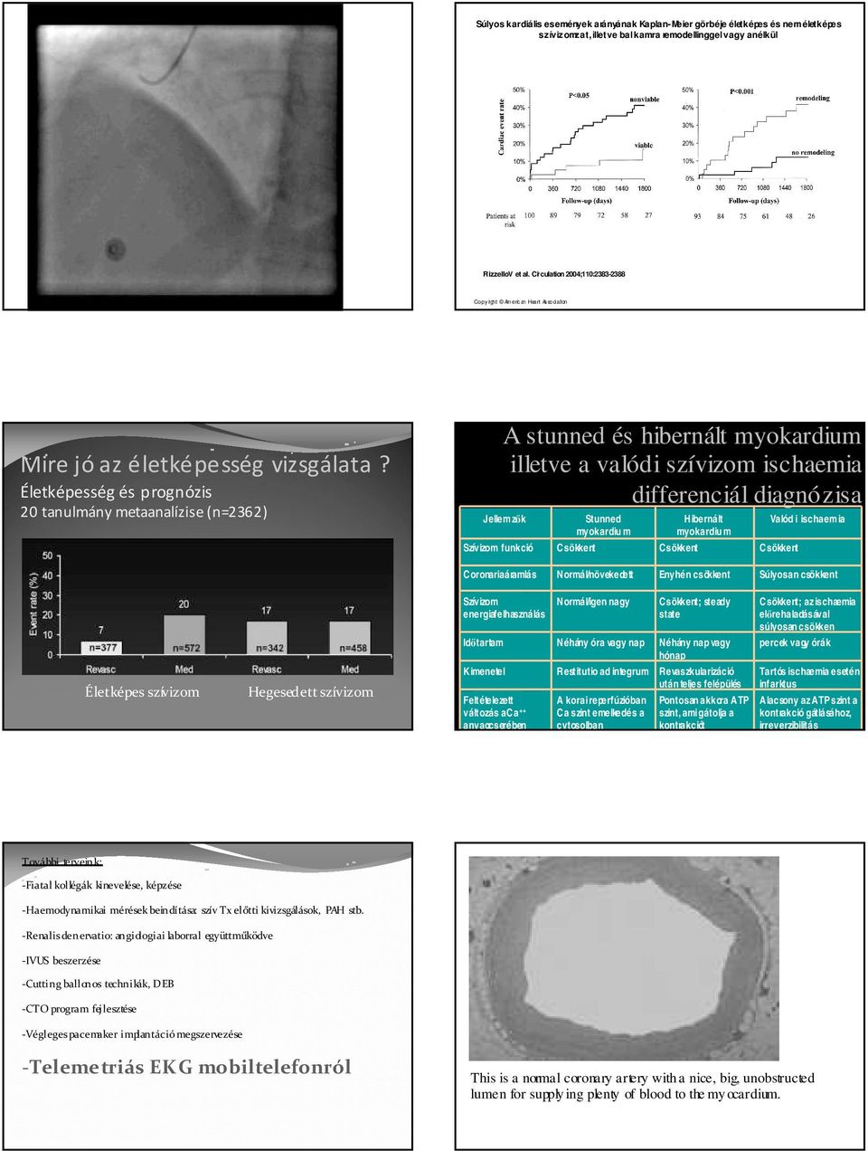 Életképesség és prognózis 20 tanulmány metaanalízise(n=2362) A stunned és hibernált myokardium illetve a valódi szívizom ischaemia differenciál diagnózisa Jellemzők Stunned myokardiu m Hibernált