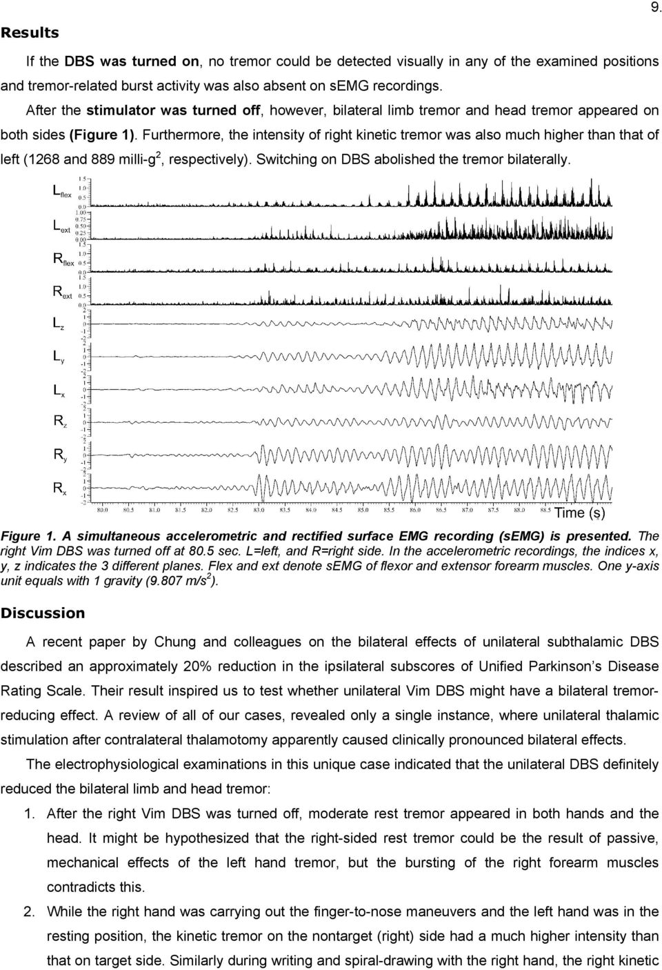 Furthermore, the intensity of right kinetic tremor was also much higher than that of left (1268 and 889 milli-g 2, respectively). Switching on DBS abolished the tremor bilaterally. Figure 1.