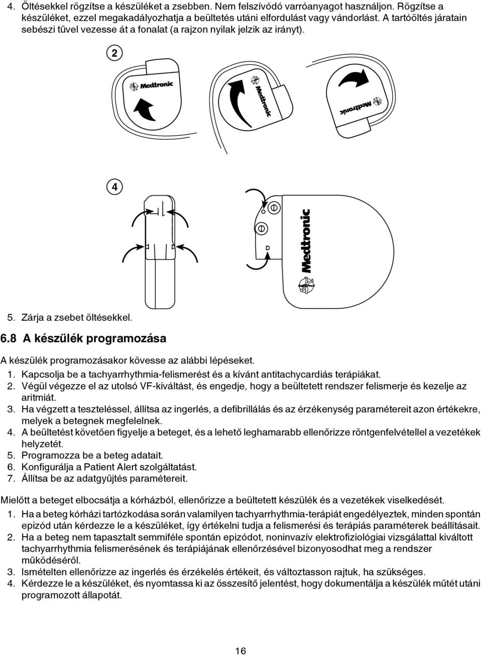 8 A készülék programozása A készülék programozásakor kövesse az alábbi lépéseket. 1. Kapcsolja be a tachyarrhythmia-felismerést és a kívánt antitachycardiás terápiákat. 2.