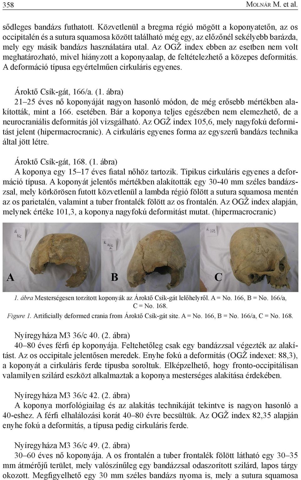 Az OGŽ index ebben az esetben nem volt meghatározható, mivel hiányzott a koponyaalap, de feltételezhető a közepes deformitás. A deformáció típusa egyértelműen cirkuláris egyenes.