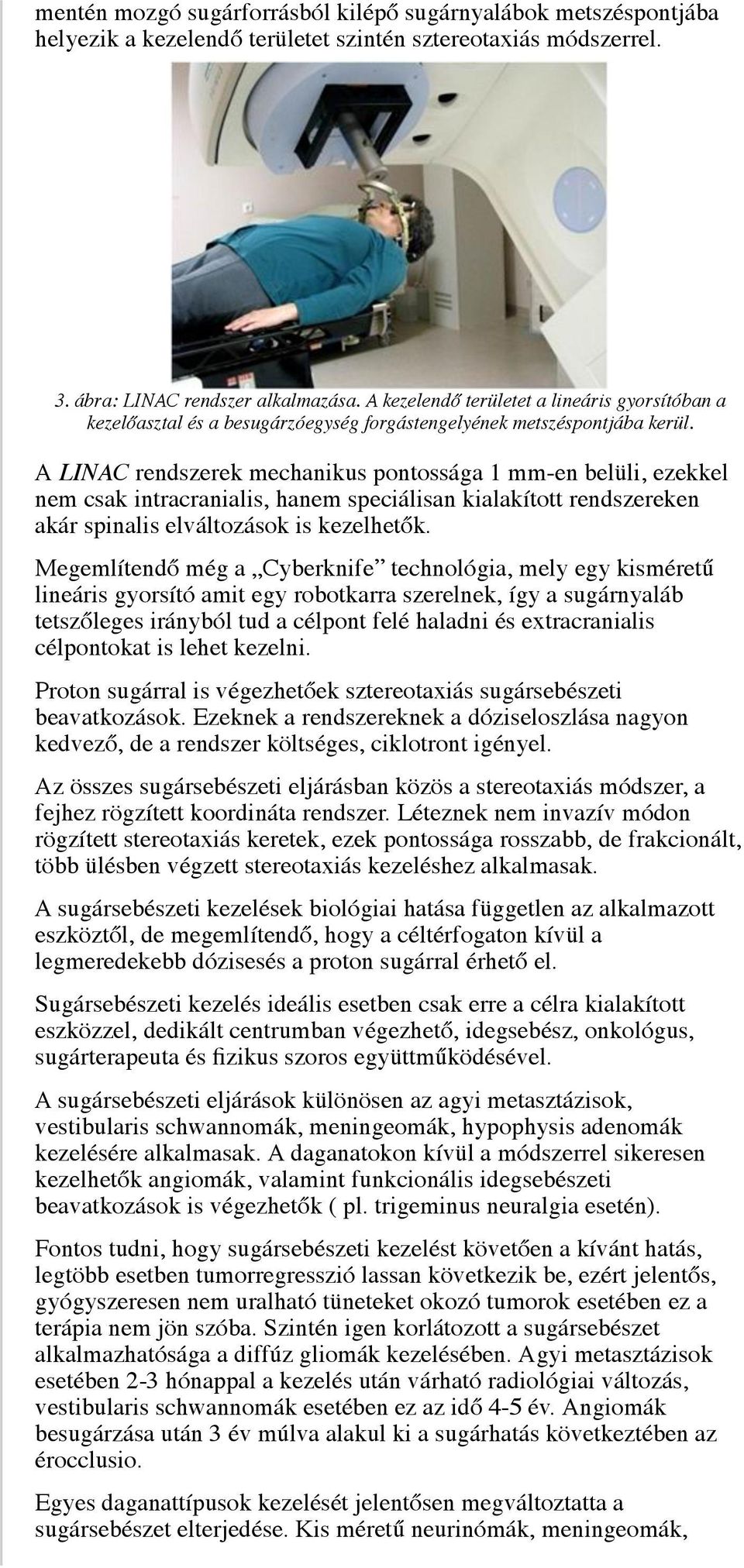 A LINAC rendszerek mechanikus pontossága 1 mm-en belüli, ezekkel nem csak intracranialis, hanem speciálisan kialakított rendszereken akár spinalis elváltozások is kezelhetők.