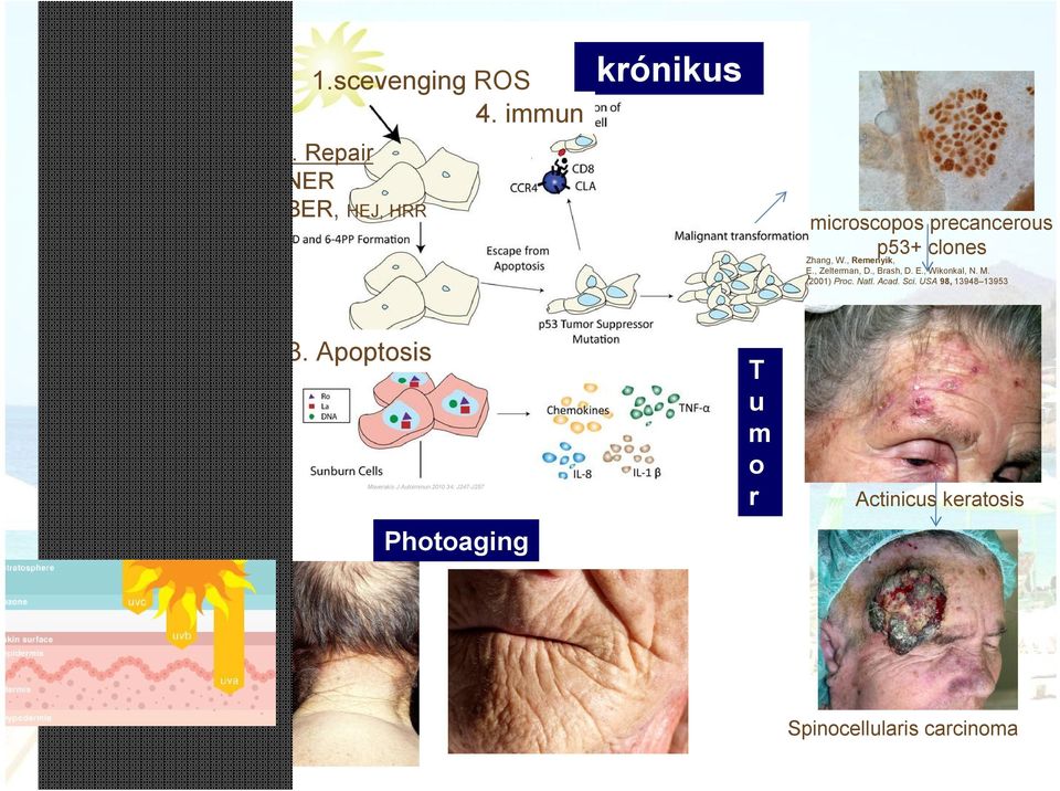 USA 98, 13948 13953 Dermatitis solaris 3.