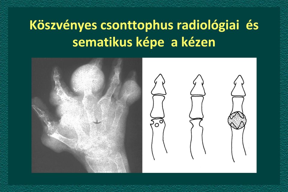 radiológiai és