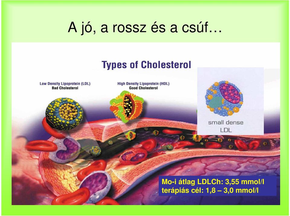 LDLCh: 3,55 mmol/l