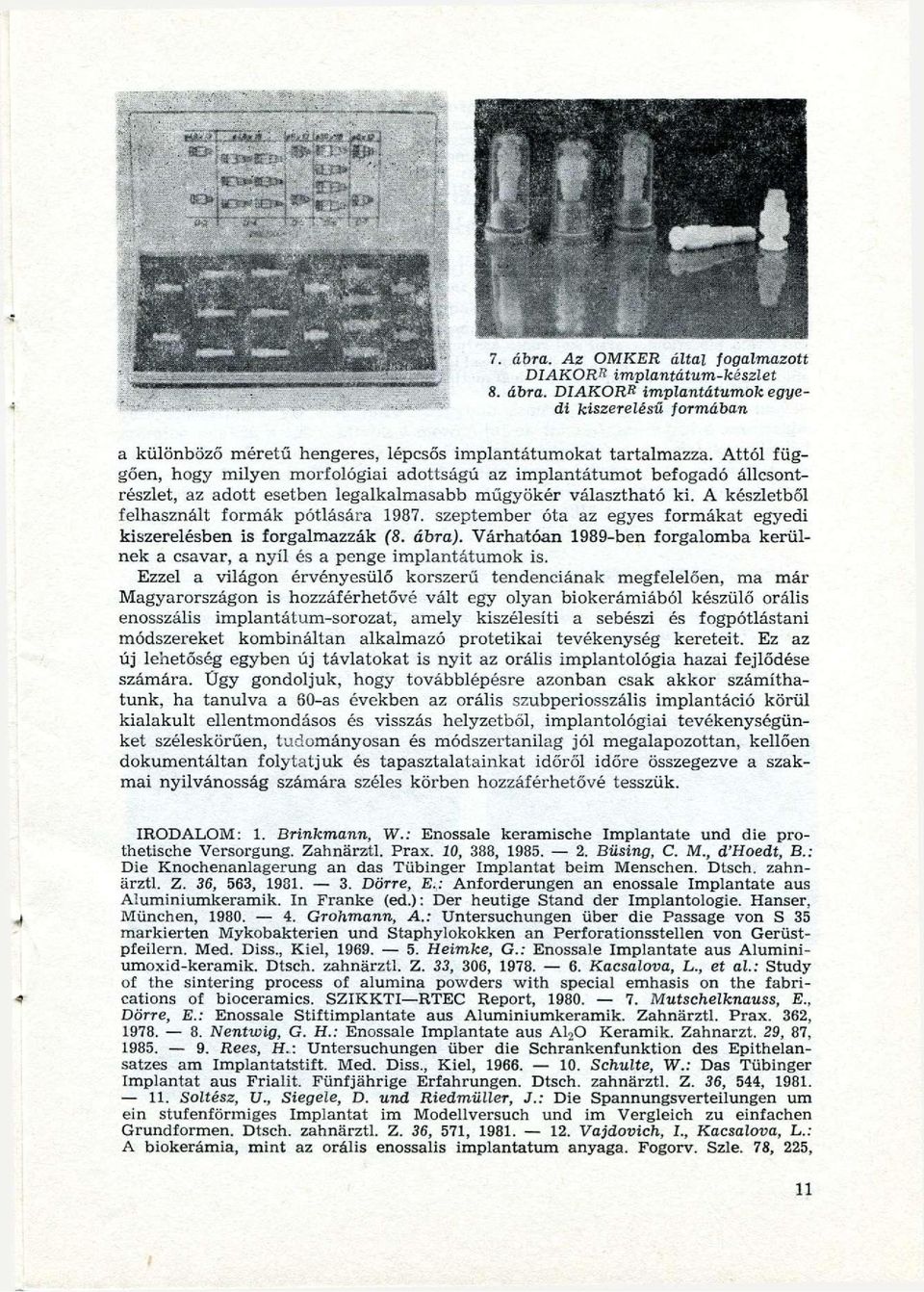 szeptember óta az egyes formákat egyedi kiszerelésben is forgalmazzák (8. ábra). Várhatóan 1989-ben forgalomba kerülnek a csavar, a nyíl és a penge implantátumok is.