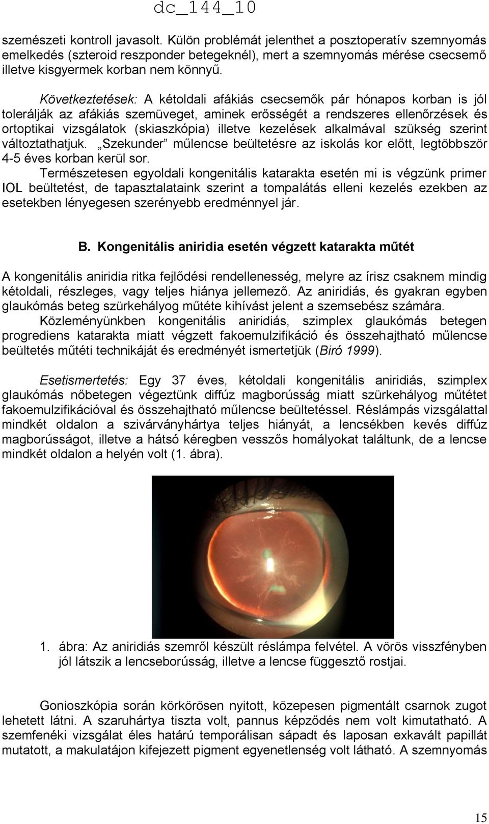 kezelések alkalmával szükség szerint változtathatjuk. Szekunder műlencse beültetésre az iskolás kor előtt, legtöbbször 4-5 éves korban kerül sor.