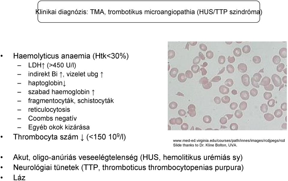 Thrombocyta szám (<150 10 9 /l) www.med-ed.virginia.edu/courses/path/innes/images/rcdjpegs/rcd Slide thanks to Dr.