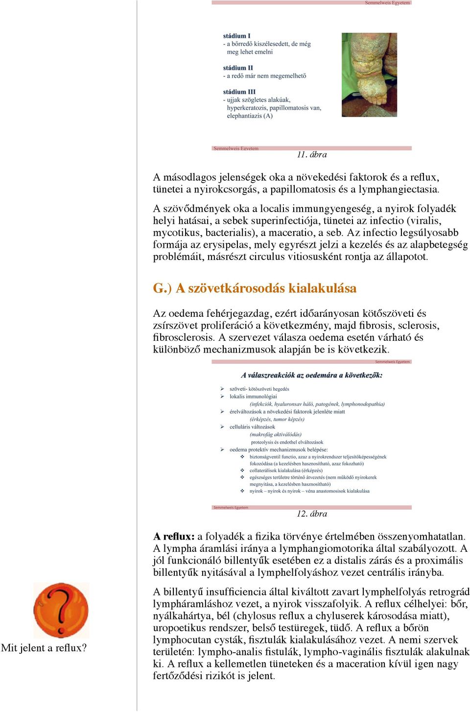 Az infectio legsúlyosabb formája az erysipelas, mely egyrészt jelzi a kezelés és az alapbetegség problémáit, másrészt circulus vitiosusként rontja az állapotot. G.