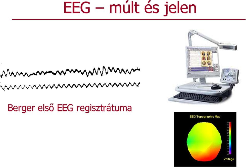 elsı EEG