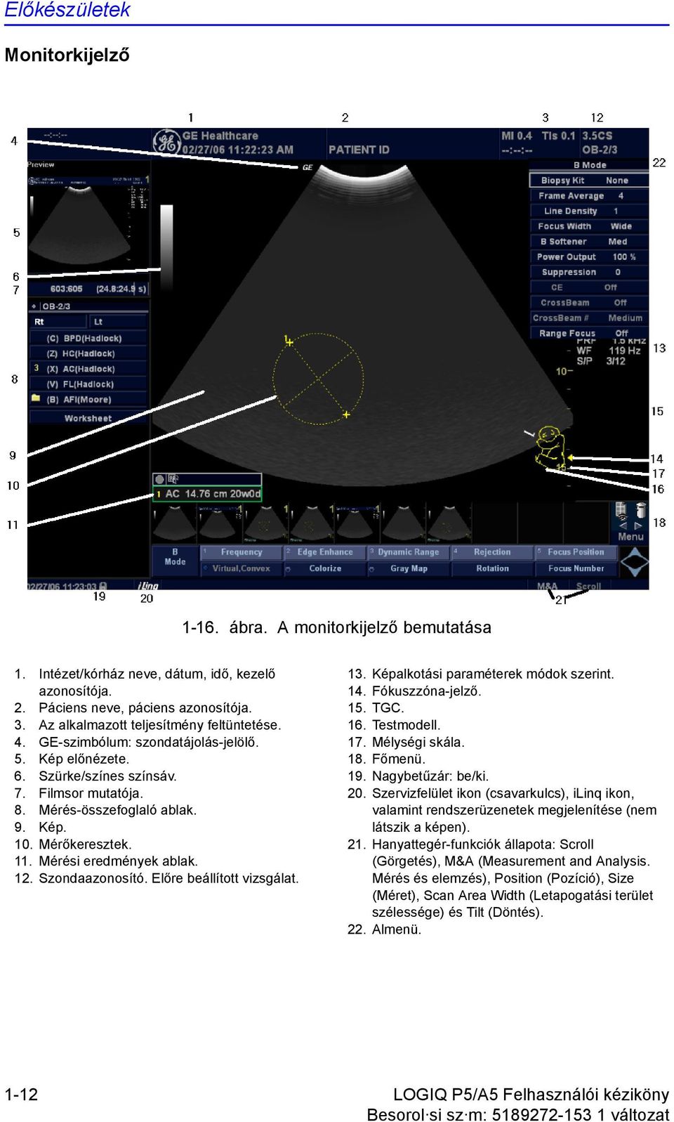 Mérőkeresztek. 11. Mérési eredmények ablak. 12. Szondaazonosító. Előre beállított vizsgálat. 13. Képalkotási paraméterek módok szerint. 14. Fókuszzóna-jelző. 15. TGC. 16. Testmodell. 17.