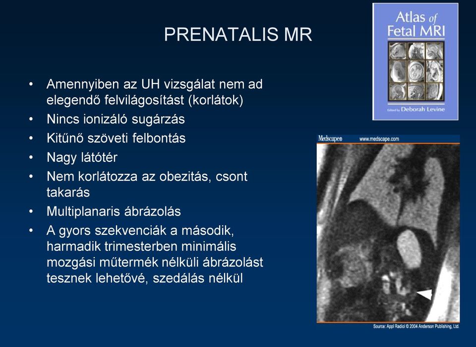 obezitás, csont takarás Multiplanaris ábrázolás A gyors szekvenciák a második,