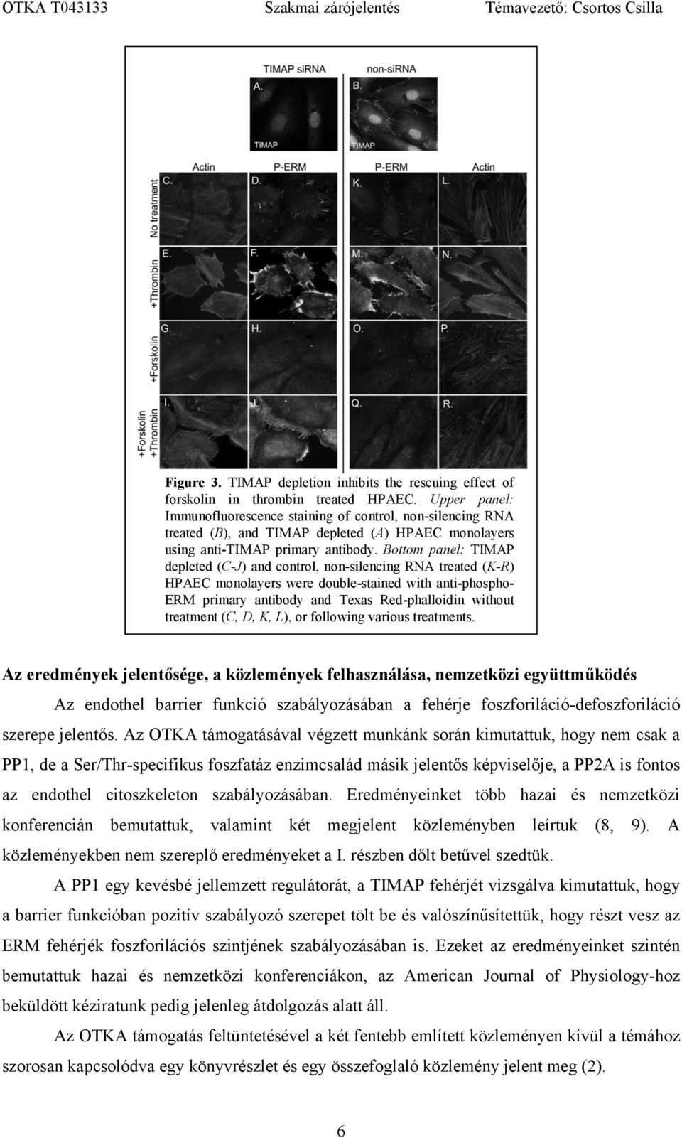 Bottom panel: TIMAP depleted (C-J) and control, non-silencing RNA treated (K-R) HPAEC monolayers were double-stained with anti-phospho- ERM primary antibody and Texas Red-phalloidin without treatment