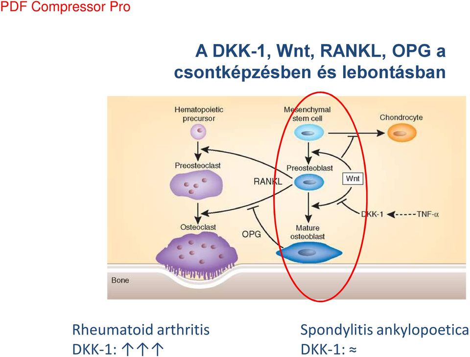Rheumatoid arthritis DKK-1: