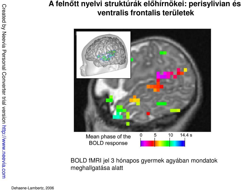 területek BOLD fmri jel 3 hónapos gyermek