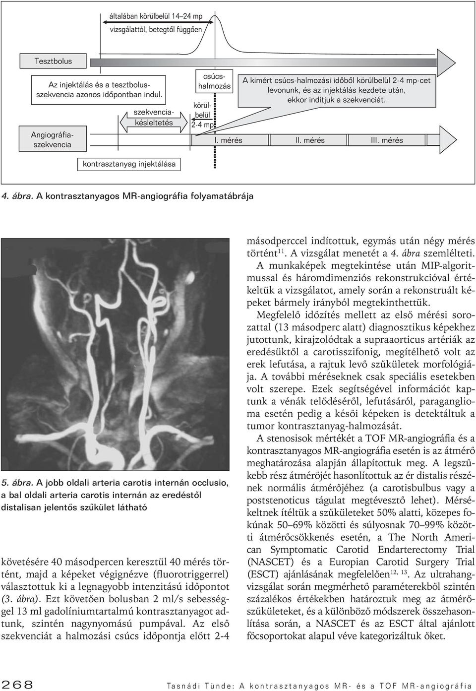 A jobb oldali arteria carotis internán occlusio, a bal oldali arteria carotis internán az eredéstôl distalisan jelentôs szûkület látható követésére 40 másodpercen keresztül 40 mérés történt, majd a