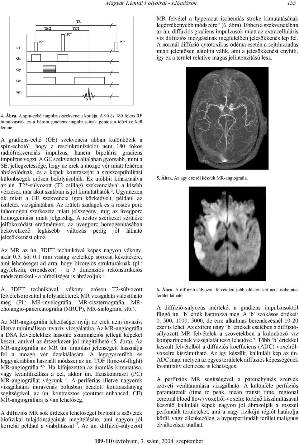 A normál diffúzió cytotoxikus ödéma esetén a sejtduzzadás miatt jelentősen gátolttá válik, ami a jelcsökkenést enyhíti, így ez a terület relatíve magas jelintenzitású lesz. 4. Ábra.