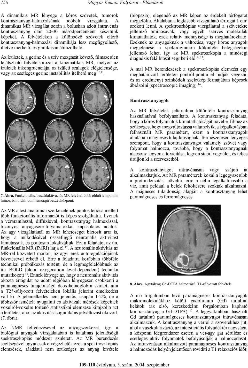 A felvételeken a különböző szövetek eltérő kontrasztanyag-halmozási dinamikája lesz megfigyelhető, illetve mérhető, és grafikusan ábrázolható.