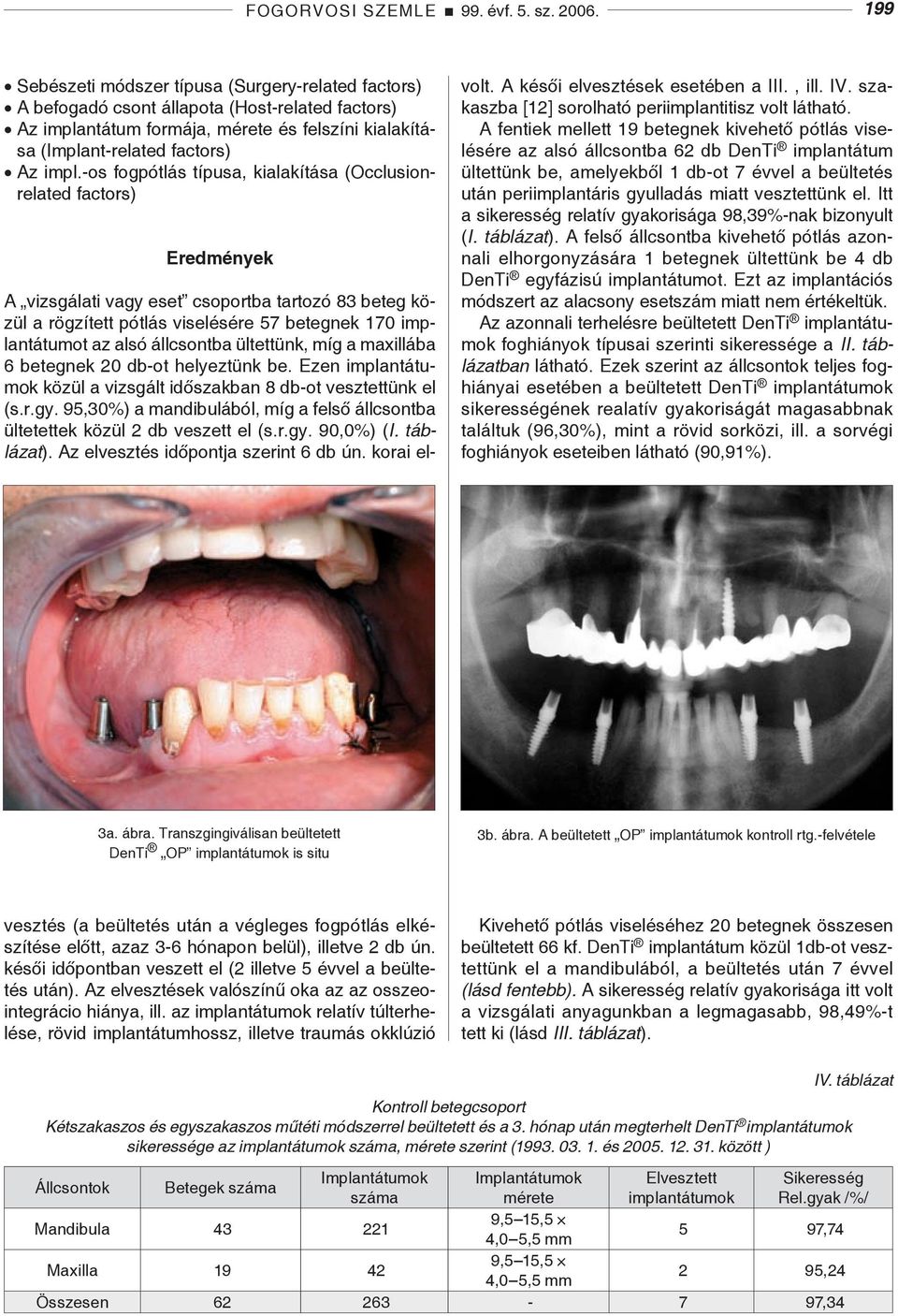 -os fogpótlás típusa, kialakítása (Occlusionrelated factors) Eredmények volt. A késői elvesztések esetében a III., ill. IV. szakaszba [12] sorolható periimplantitisz volt látható.