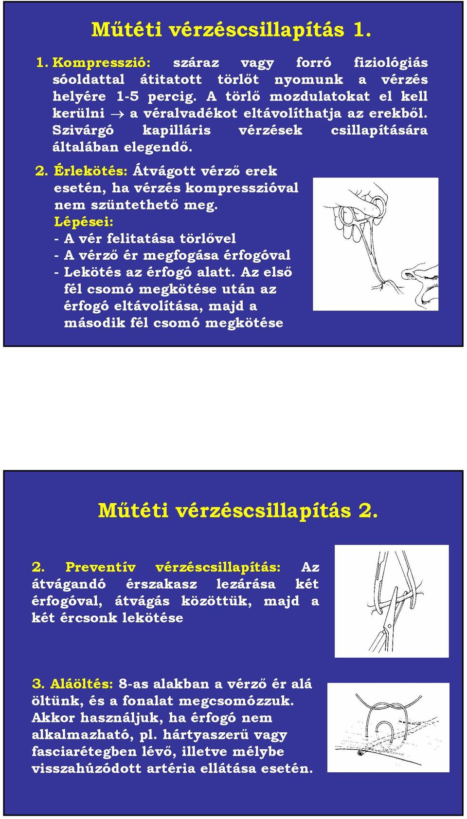 Érlekötés: Átvágott vérző erek esetén, ha vérzés kompresszióval nem szüntethető meg. Lépései: - A vér felitatása törlővel -A vérző ér megfogása érfogóval - Lekötés az érfogó alatt.