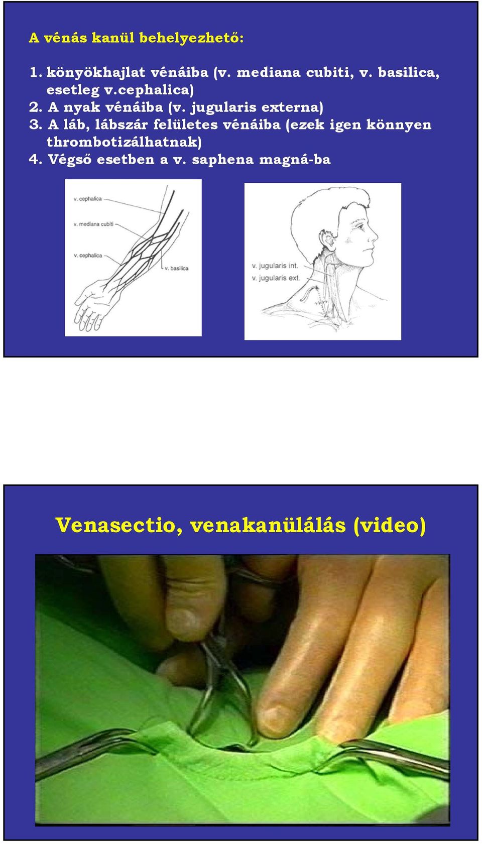 A láb, lábszár felületes vénáiba (ezek igen könnyen thrombotizálhatnak) 4.
