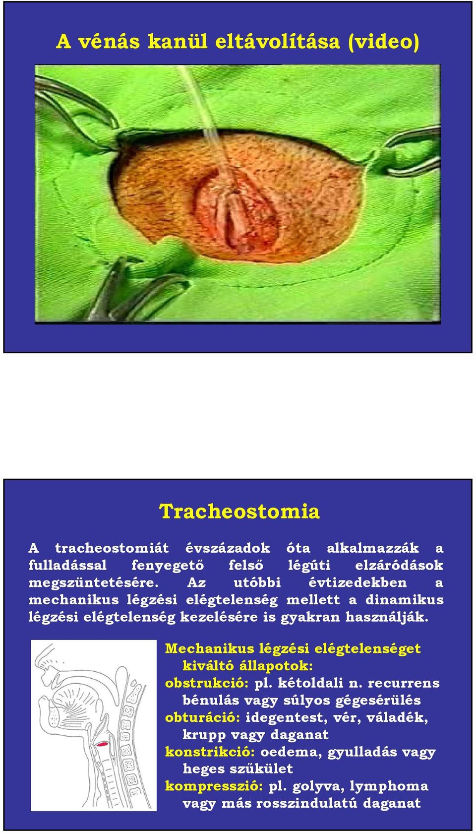 Az utóbbi évtizedekben a mechanikus légzési elégtelenség mellett a dinamikus légzési elégtelenség kezelésére is gyakran használják.