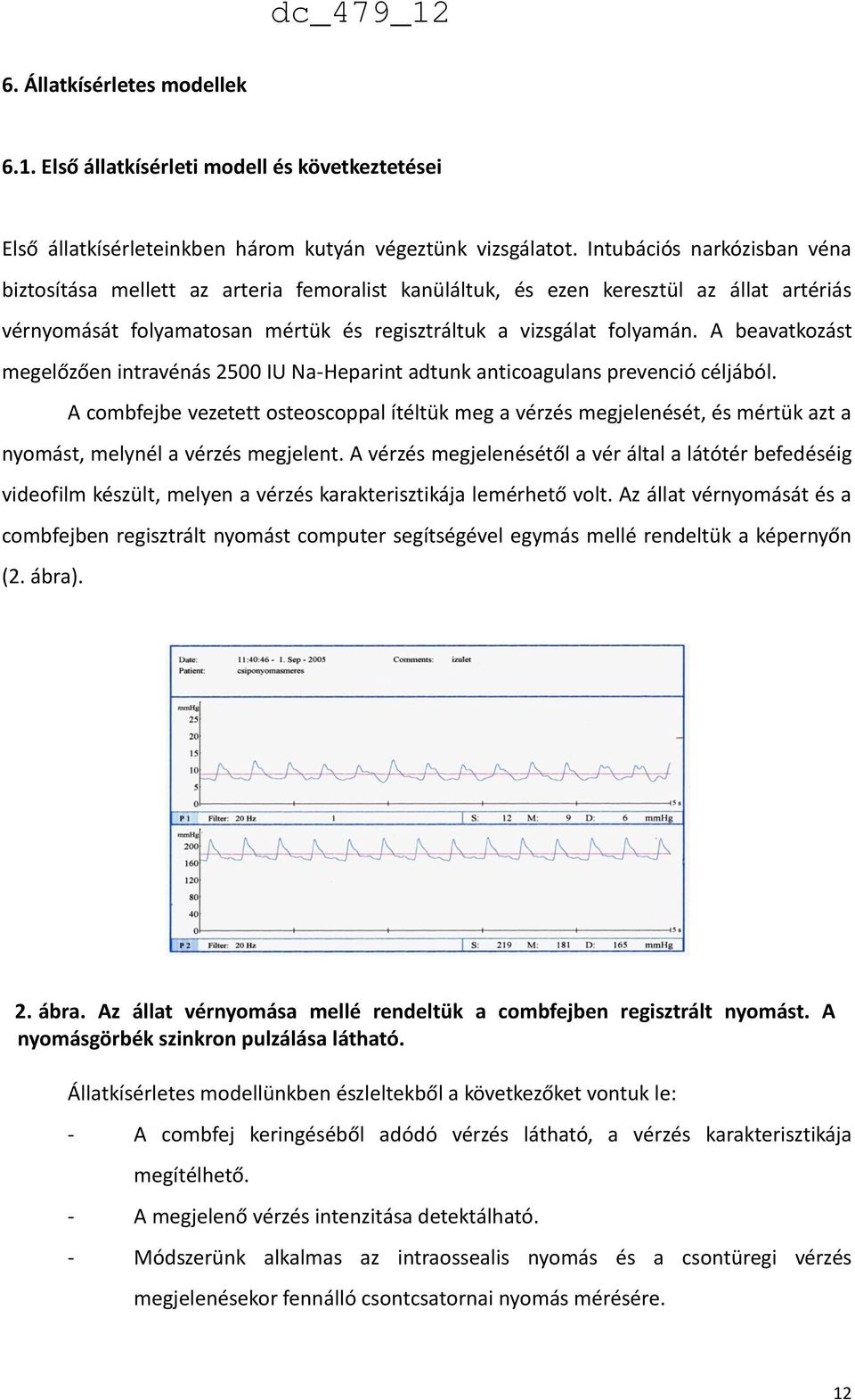 A beavatkozást megelőzően intravénás 2500 IU Na-Heparint adtunk anticoagulans prevenció céljából.