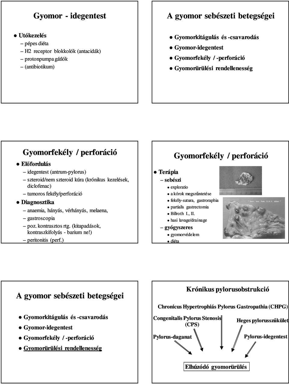 vérhányás, melaena, gastroscopia poz. kontrasztos rtg. (kitapadások, kontraszkifolyás - barium ne!) peritonitis (perf.