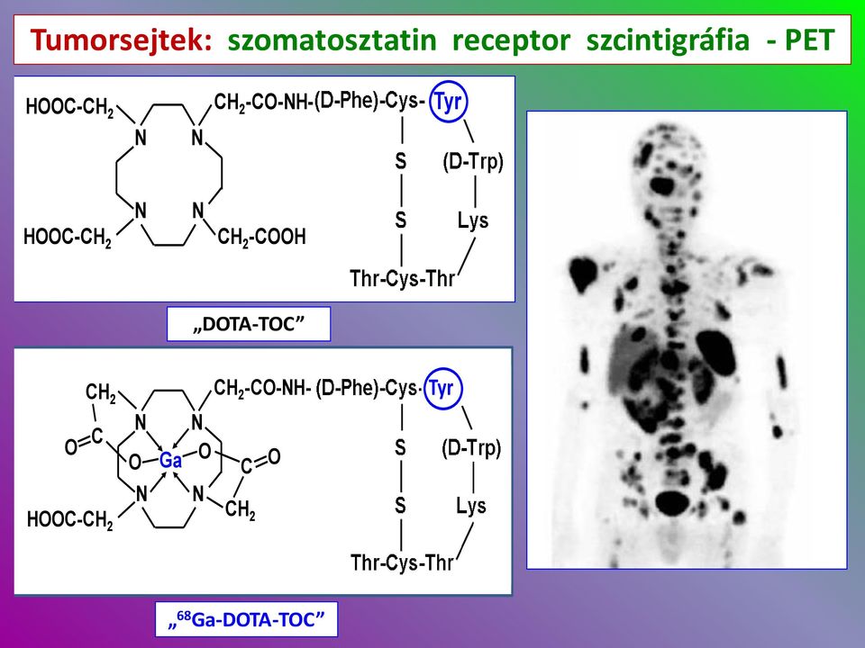 pozitronsugárzóval szcintigráfia - PET HC-CH 2 CH 2