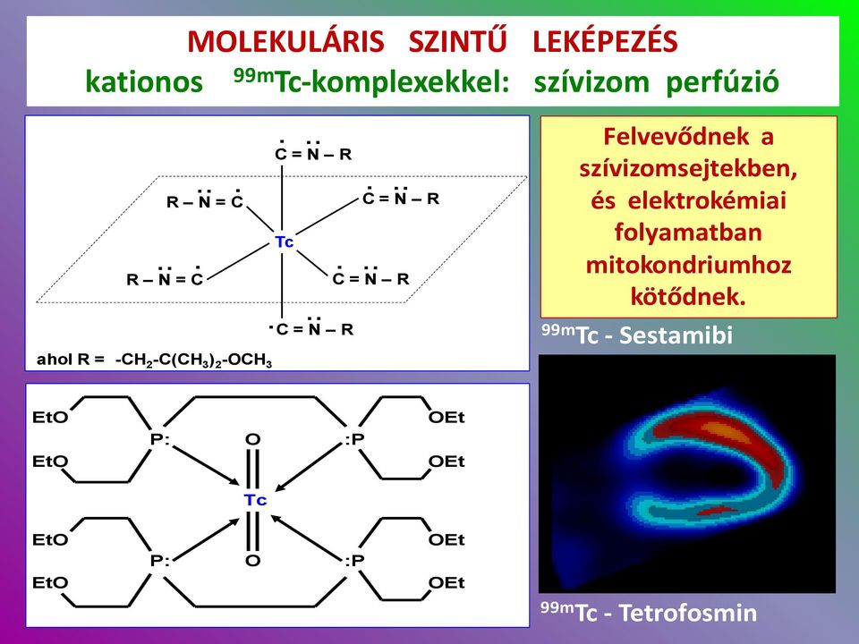 Tc-hexakis(metoxiizobutiro-izonitril), MIBI Tc: +1, = 6, Z= +1 Felvétel a szívizomban: arányos a vérátáramlással Kötődés: a mitokondriumhoz Lassú