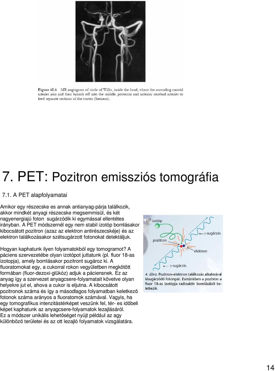 A PET módszernél egy nem stabil izotóp bomlásakor kibocsátott pozitron (azaz az elektron antirészecskéje) és az elektron találkozásakor szétsugárzott fotonokat detektáljuk.