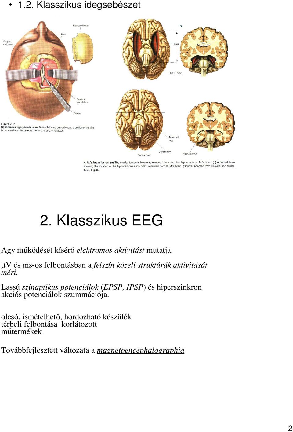 Lassú szinaptikus potenciálok (EPSP, IPSP) és hiperszinkron akciós potenciálok szummációja.