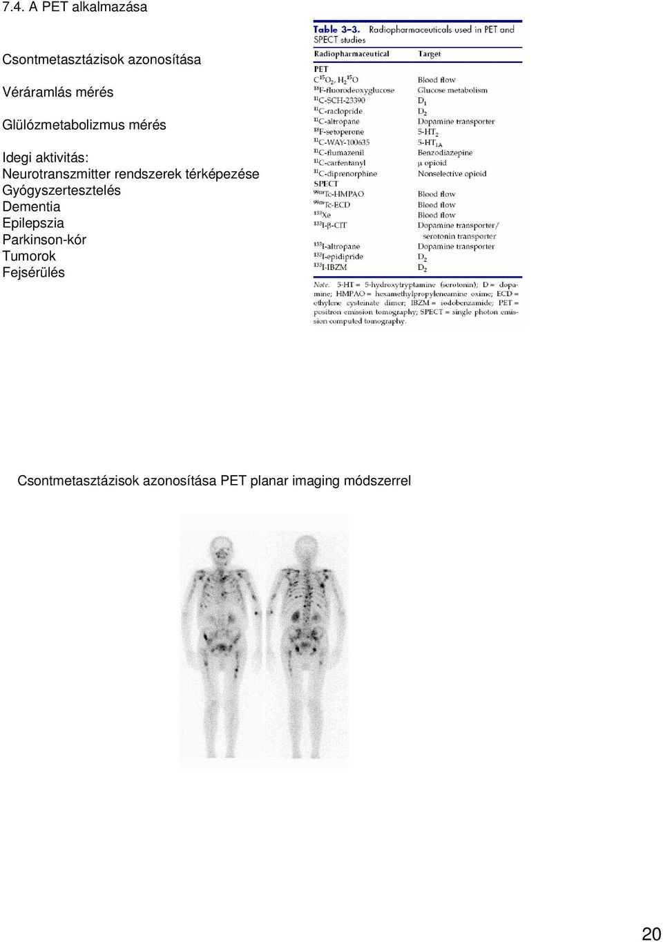 térképezése Gyógyszertesztelés Dementia Epilepszia Parkinson-kór Tumorok