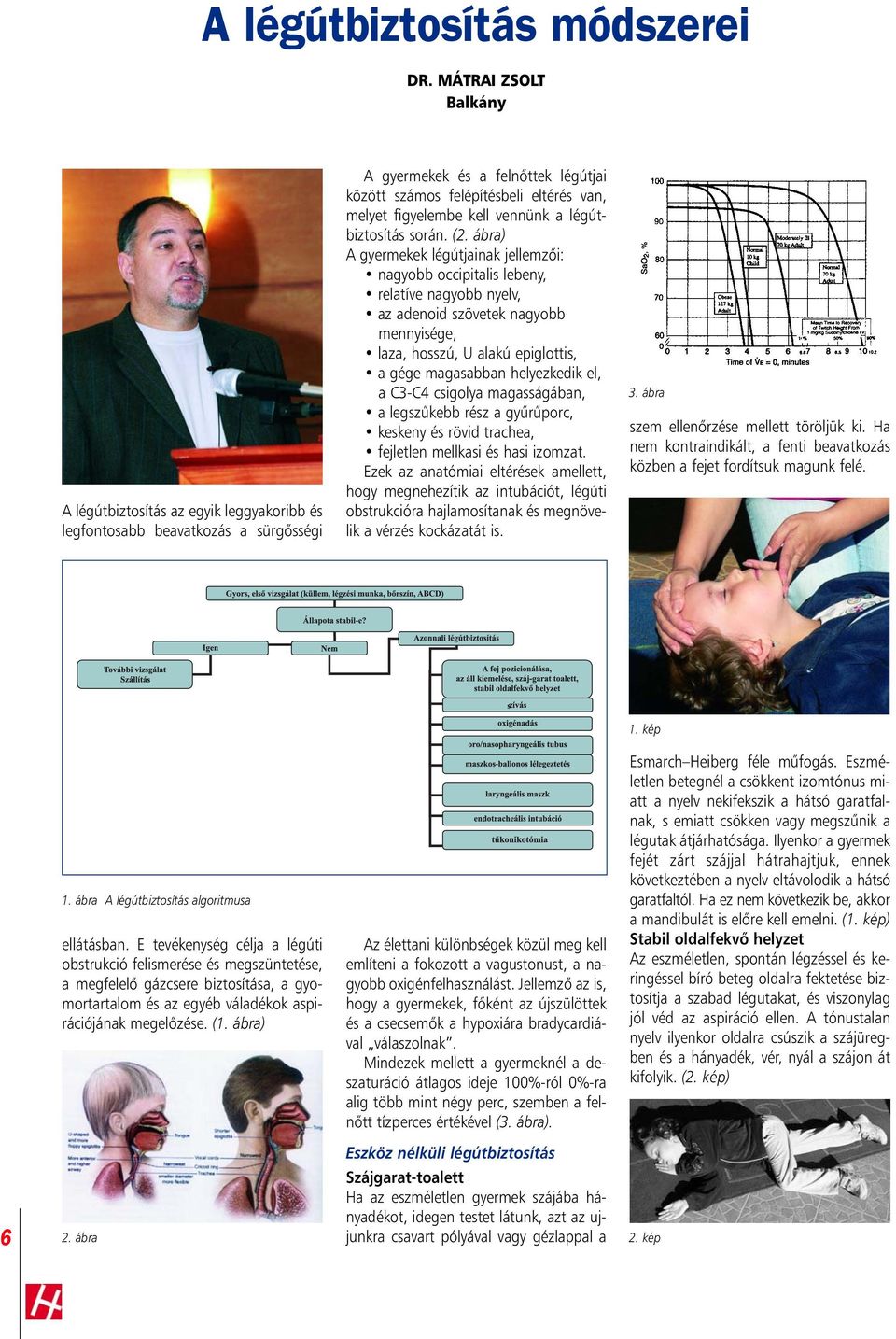 kell vennünk a légútbiztosítás során. (2.