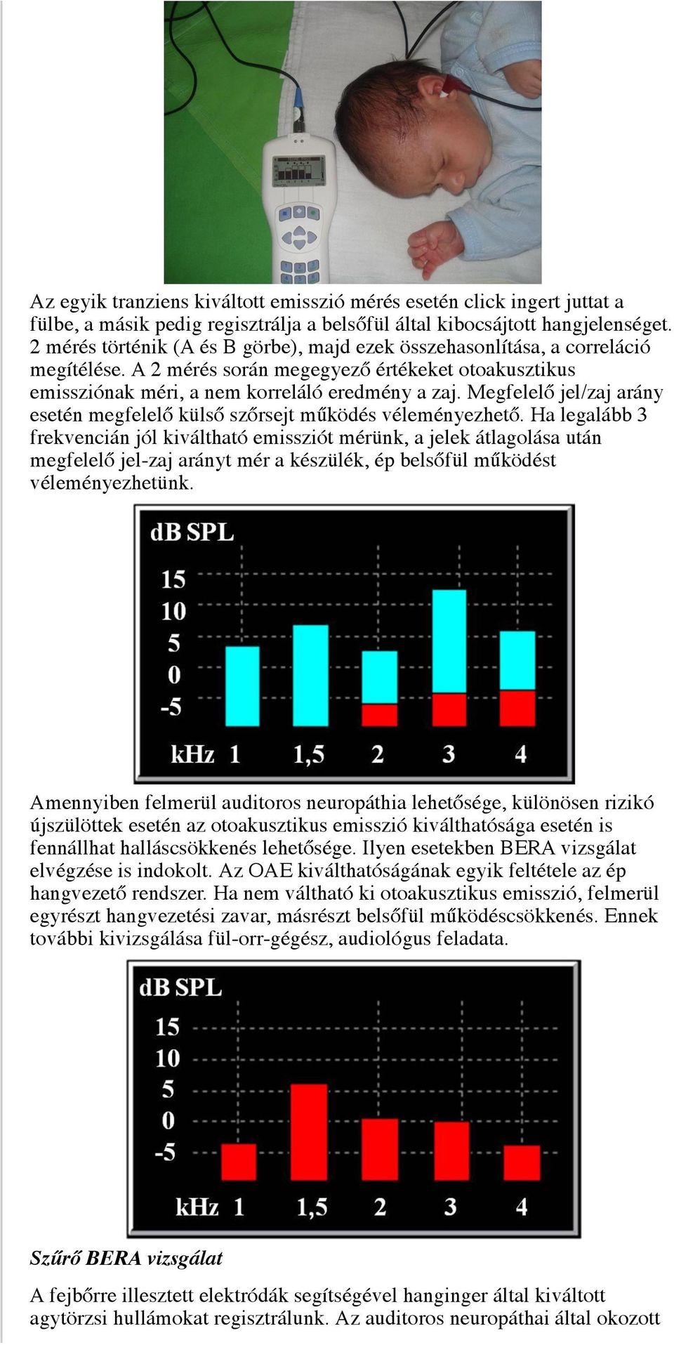 Megfelelő jel/zaj arány esetén megfelelő külső szőrsejt működés véleményezhető.