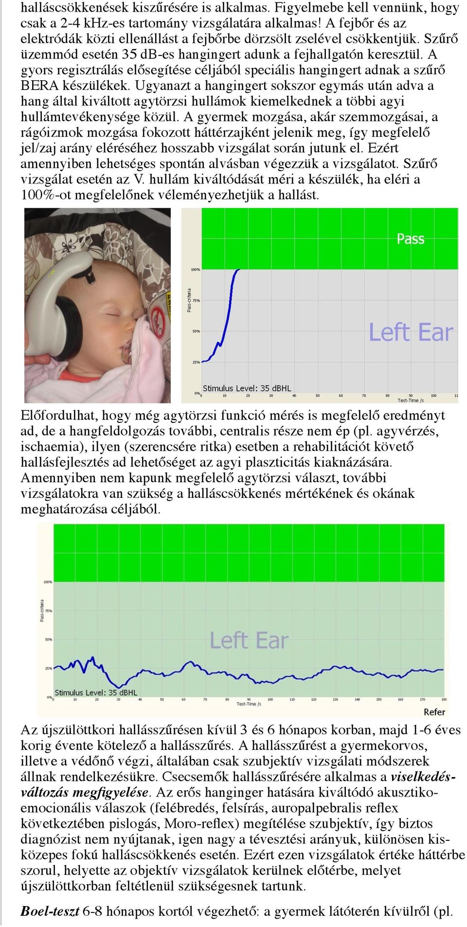 A gyors regisztrálás elősegítése céljából speciális hangingert adnak a szűrő BERA készülékek.