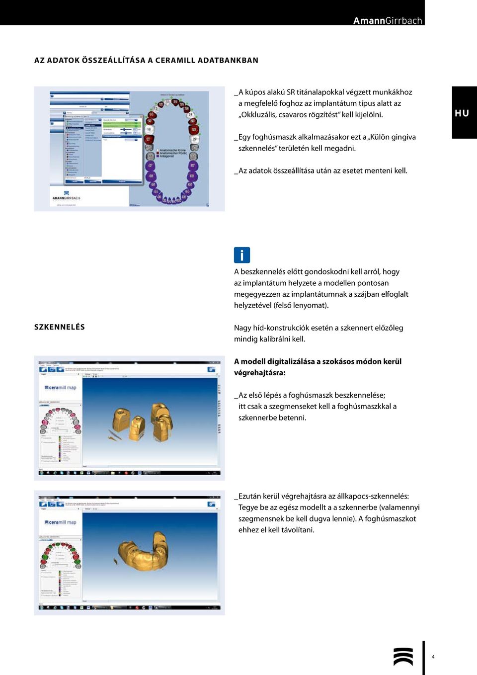 A beszkennelés előtt gondoskodni kell arról, hogy az implantátum helyzete a modellen pontosan megegyezzen az implantátumnak a szájban elfoglalt helyzetével (felső lenyomat).