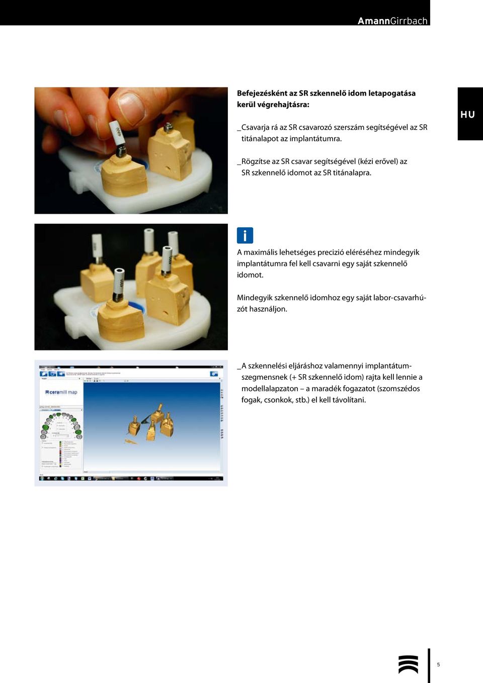 A maximális lehetséges precizió eléréséhez mindegyik implantátumra fel kell csavarni egy saját szkennelő idomot.