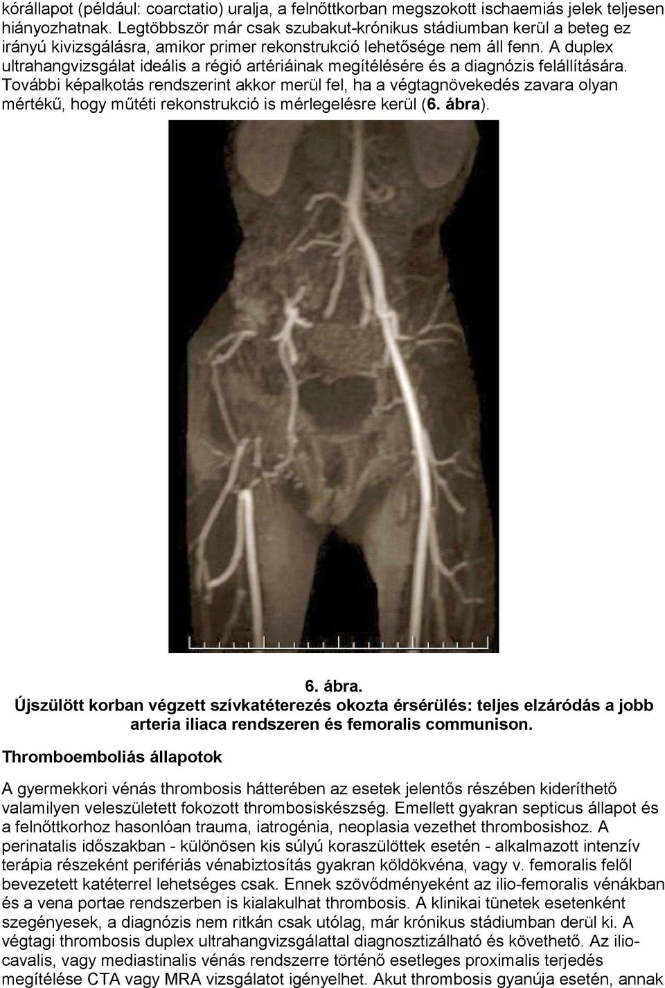 A duplex ultrahangvizsgálat ideális a régió artériáinak megítélésére és a diagnózis felállítására.